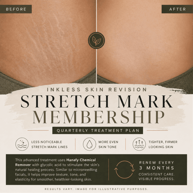 Inkless Stretch Mark Revision at Esthie Brows in Largo, FL